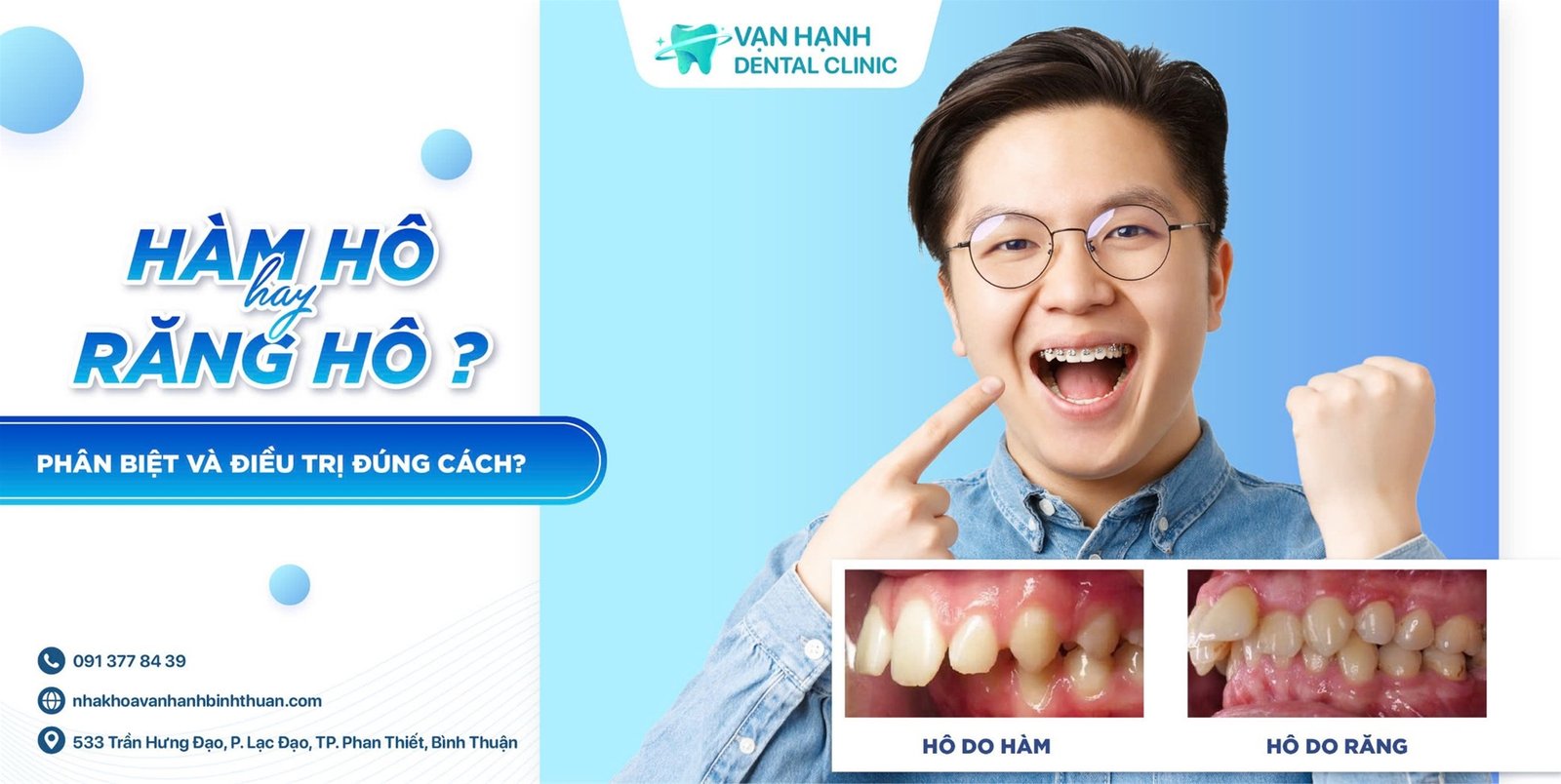 HÀM HÔ HAY RĂNG HÔ? LÀM THẾ NÀO ĐỂ PHÂN BIỆT VÀ ĐIỀU TRỊ ĐÚNG CÁCH